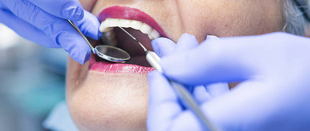 Best Emergency Treatment for Dental Infections or Abscesses in Douglass, KS